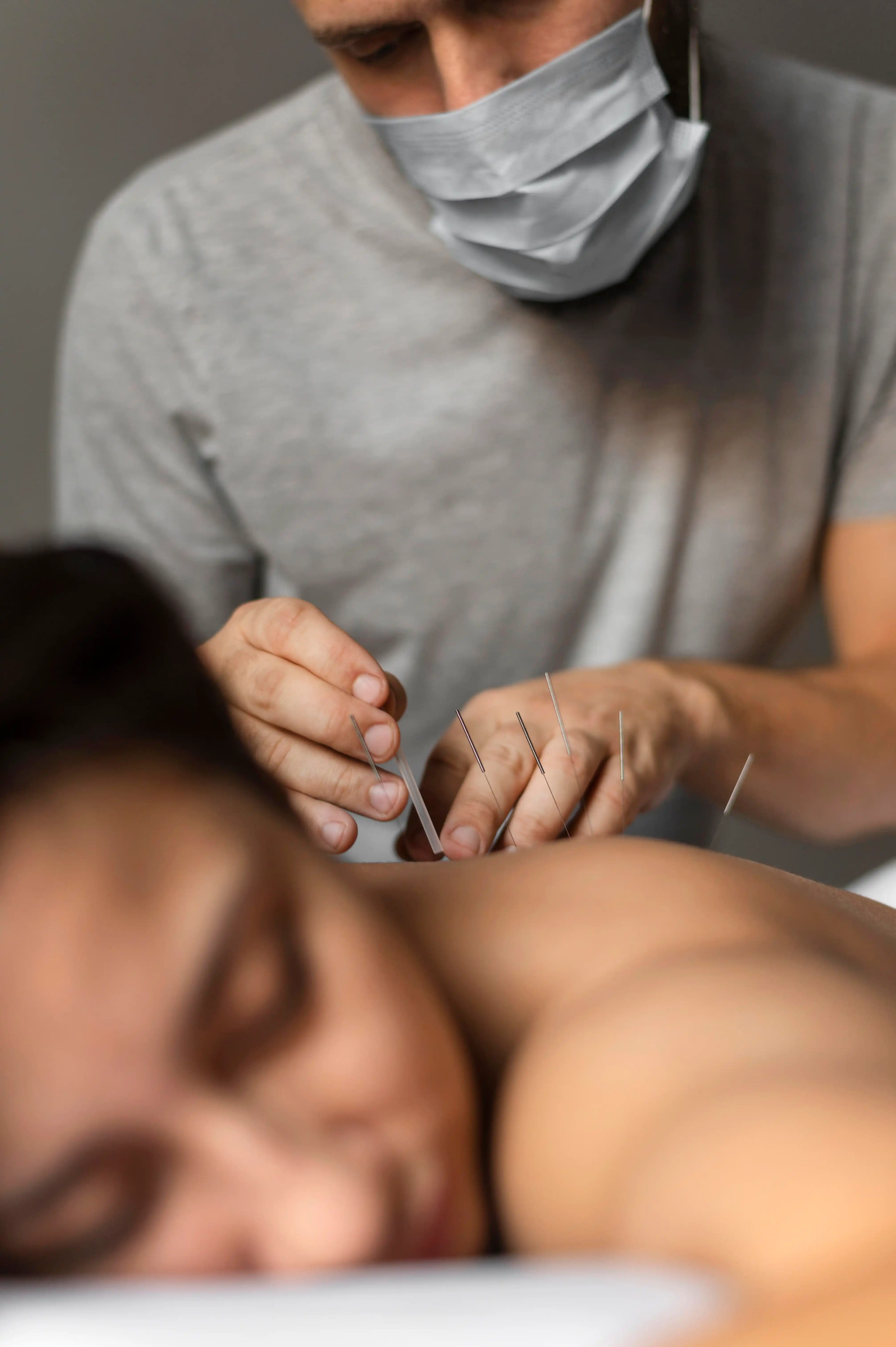 Acupuntura para Fertilidade